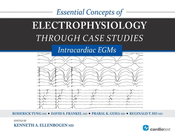 Essential Concepts of Electrophysiology Through Case Studies: Intracardiac EGMs: Intracardiac EGMs - Paperback
