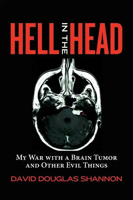 Hell in the Head: My War with a Brain Tumor and Other Evil Things - Paperback