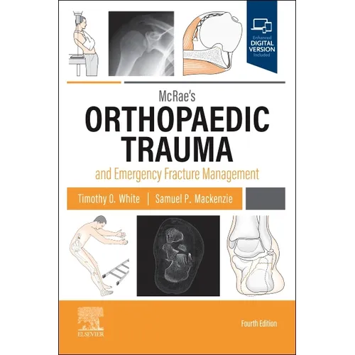 McRae's Orthopaedic Trauma and Emergency Fracture Management - Paperback