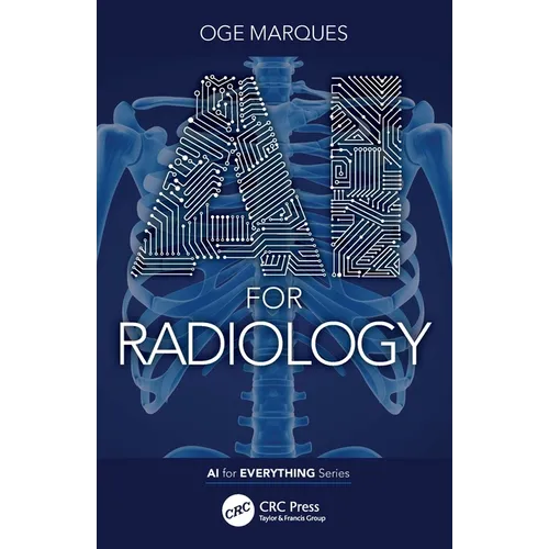 AI for Radiology - Paperback