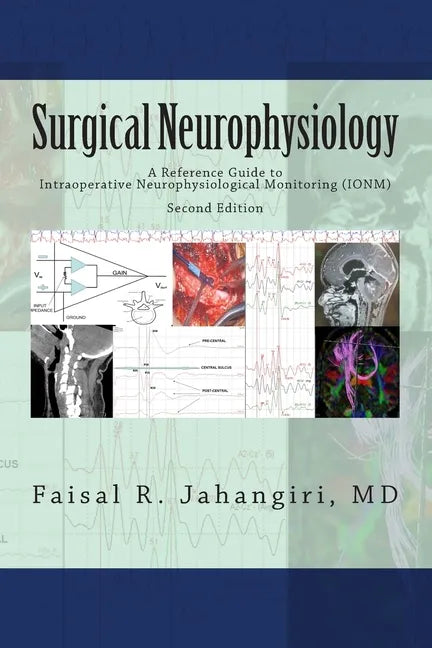 Surgical Neurophysiology - 2nd Edition: A Reference Guide to Intraoperative Neurophysiological Monitoring - Paperback