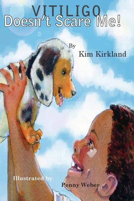 Vitiligo Doesn't Scare Me - Paperback