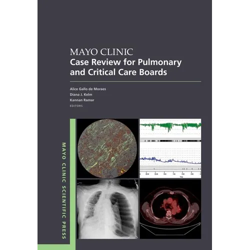 Mayo Clinic Case Review for Pulmonary and Critical Care Boards - Paperback