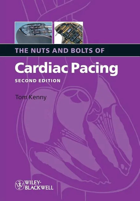 Nuts Bolts Cardiac Pacing 2e - Paperback