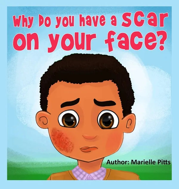 Why do you have a scar on your face? - Hardcover