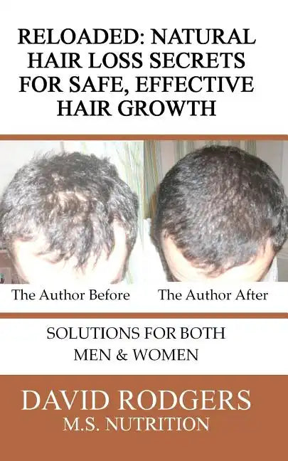 Reloaded: Natural Hair Loss Secrets for Safe, Effective Hair Growth - Paperback
