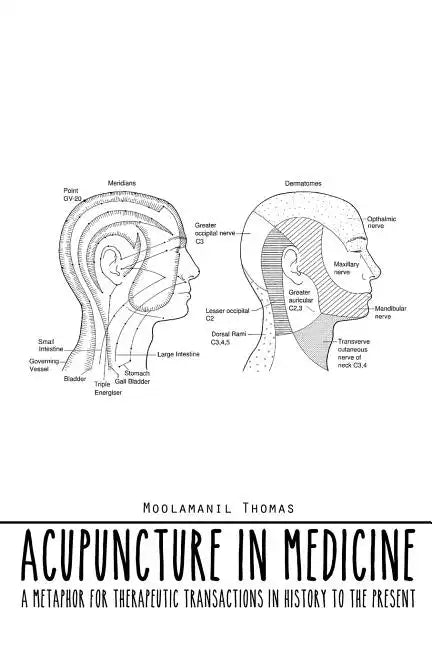 Acupuncture in Medicine: A Metaphor for Therapeutic Transactions in History to the Present - Paperback