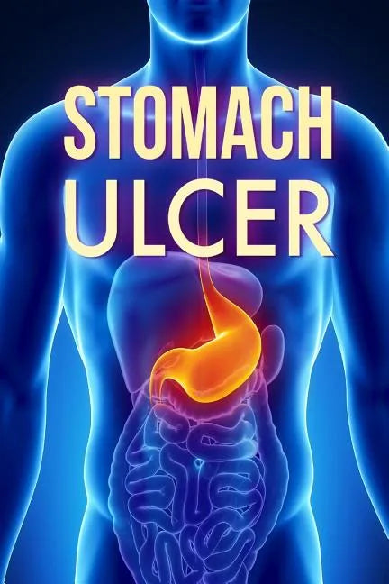 Stomach Ulcer: Treatment in 60 days!: Stomach Ulcer treatment - Paperback