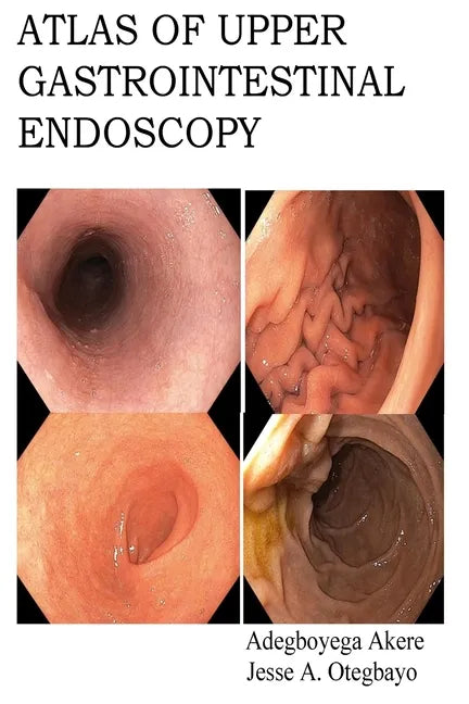 Atlas of Upper Gastrointestinal Endoscopy - Paperback