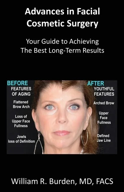 Advances in Facial Cosmetic Surgery: Your Guide to Achieving the Best Long-Term Results - Paperback