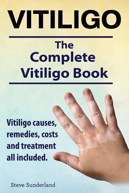 Vitiligo. Vitiligo causes, remedies, costs and treatment all included. The complete Vitiligo Book. - Paperback