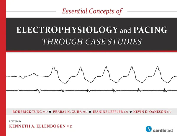 Essential Concepts of Electrophysiology and Pacing Through Case Studies - Paperback