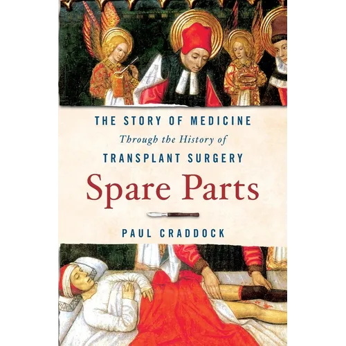Spare Parts: The Story of Medicine Through the History of Transplant Surgery - Paperback