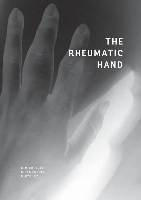 The Rheumatic Hand - Paperback