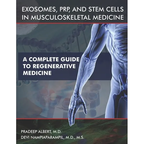 Exosomes, PRP, and Stem Cells In Musculoskeletal Medicine: A Complete Guide To Regenerative Medicine - Paperback