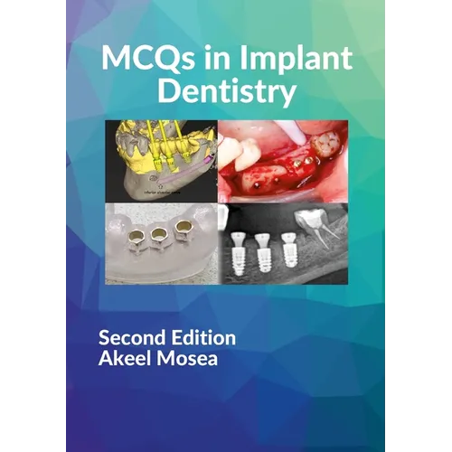 MCQs in Implant Dentistry - Paperback