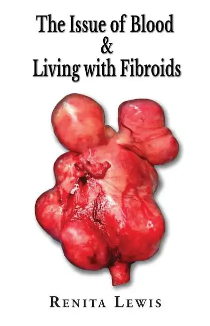 The Issue Of Blood & Living with Fibroids - Paperback