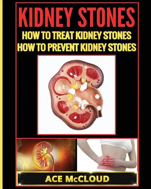Kidney Stones: How To Treat Kidney Stones: How To Prevent Kidney Stones - Paperback