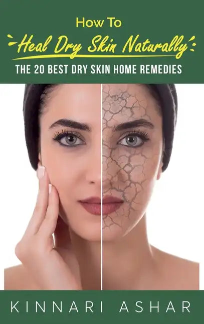 How to Heal Dry Skin Naturally: The 20 Best Dry Skin Home Remedies - Hardcover