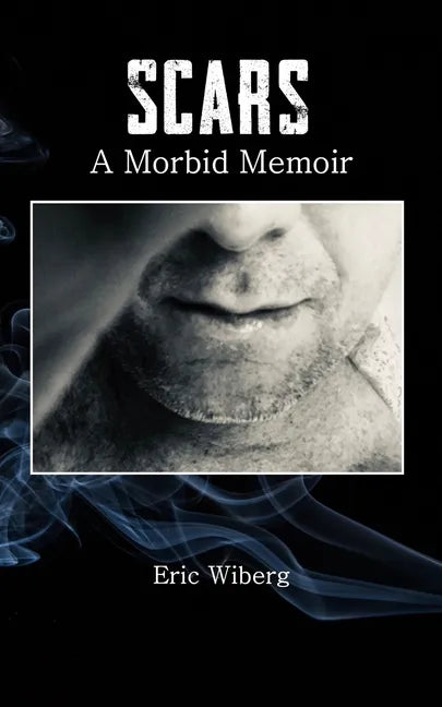 Scars: A Morbid Memoir - Paperback