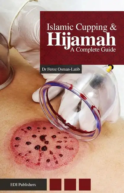 Islamic Cupping & Hijamah: A Complete Guide - Paperback