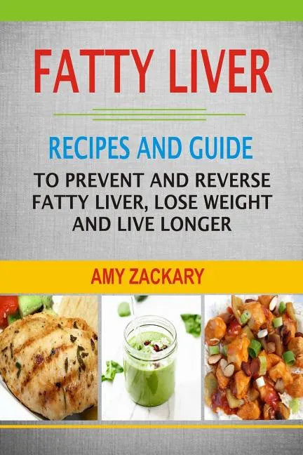 Fatty Liver: Recipes And Guide To Prevent And Reverse Fatty Liver, Lose Weight And Live Longer - Paperback