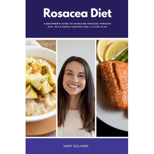 Rosacea Diet: A Beginner's Guide to Managing Rosacea Through Diet, With Sample Recipes and a 5-Step Plan - Paperback