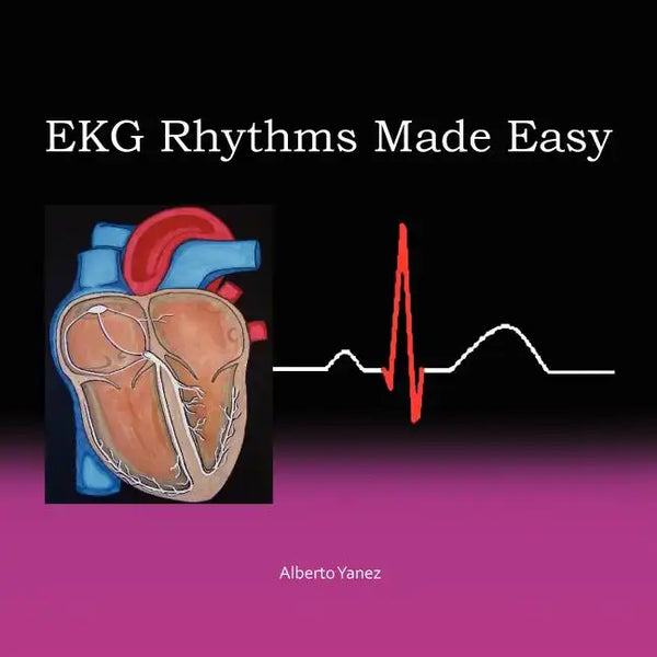 EKG Rhythms Made Easy - Paperback