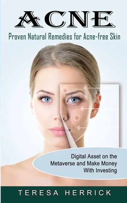 Acne: Proven Natural Remedies for Acne-free Skin (Learn About the Most Recent Updated Natural Acne) - Paperback