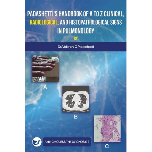 Padashetti's Textbook on A to Z Signs in Pulmonology - Paperback