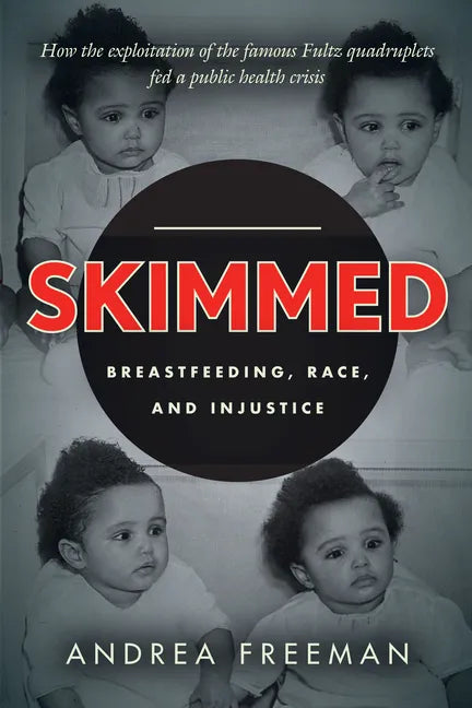 Skimmed: Breastfeeding, Race, and Injustice - Paperback