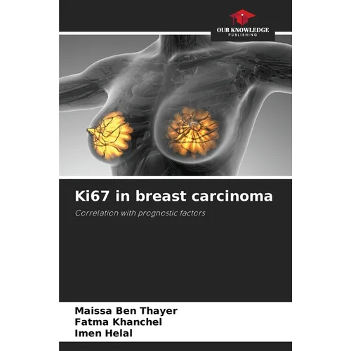 Ki67 in breast carcinoma - Paperback