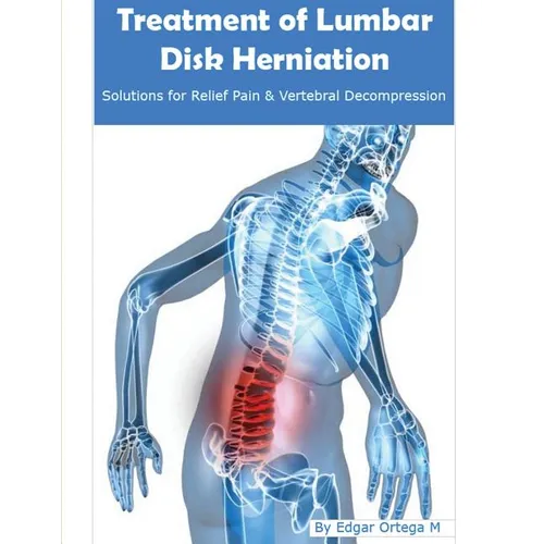 Treatment of Lumbar Disk Herniation: Back Pain Relief and Herniated Discs Solutions - Paperback